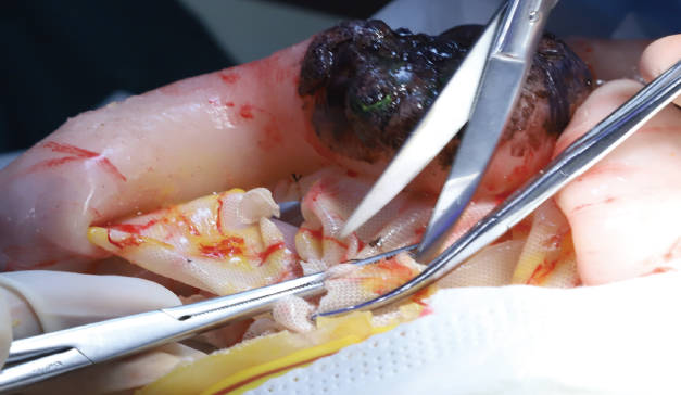 模擬手術(shù)綜合訓練系統(tǒng)