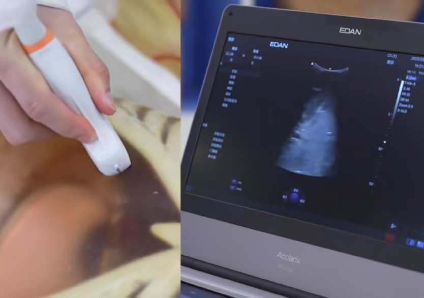 綜合超聲檢查平臺3.0